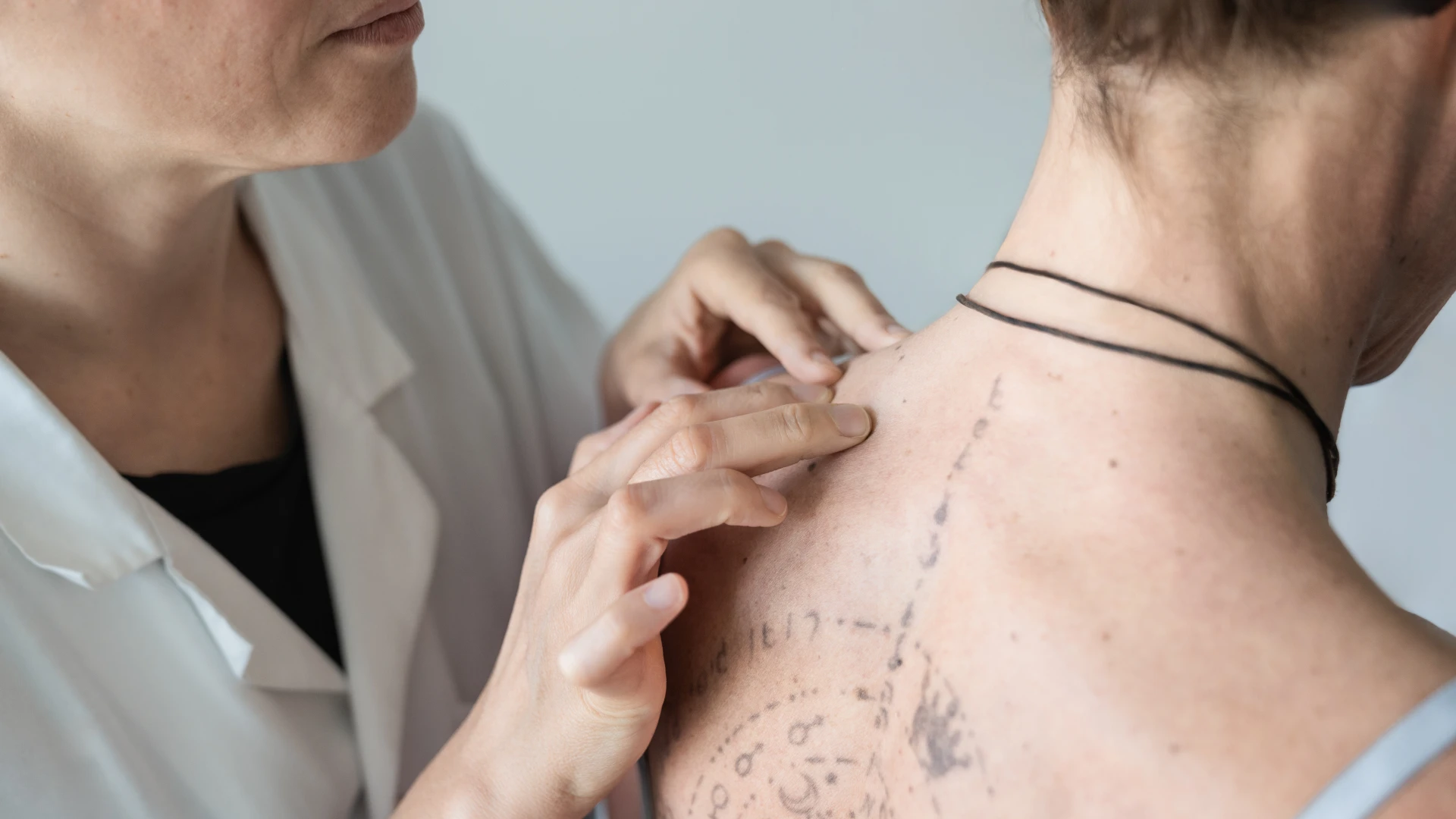 Diagnostic de l'arthrite psoriasique Diagnostic de l'arthrite psoriasique