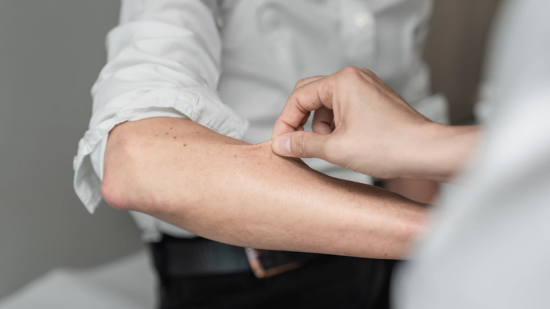 Diagnostic Syndromes d'Ehlers-Danlos (SED) Diagnostic Syndromes d'Ehlers-Danlos (SED)