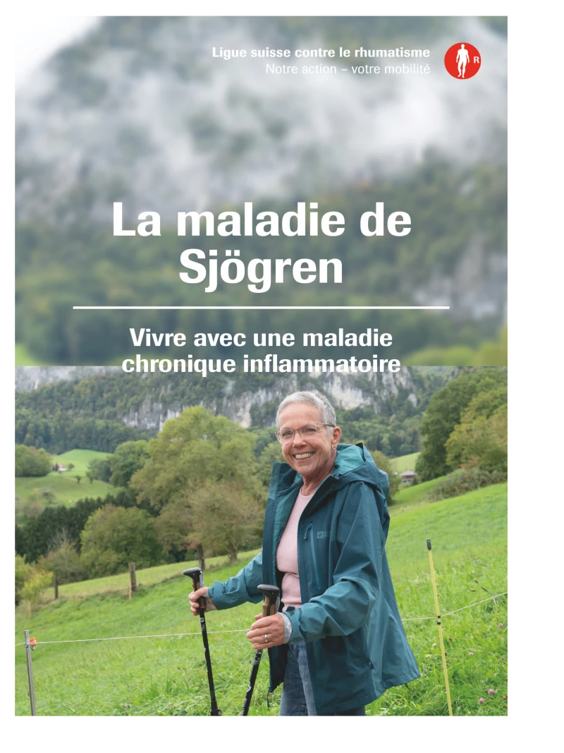La maladie de Sjögren La maladie de Sjögren