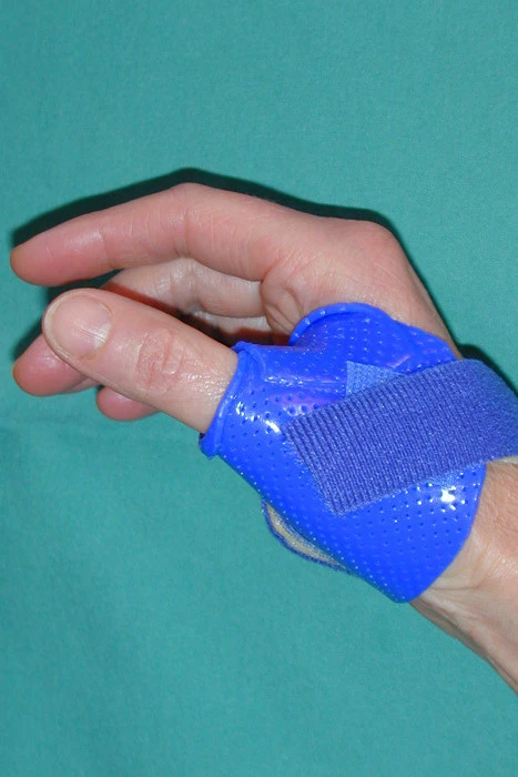rhizarthrose rhizarthrose