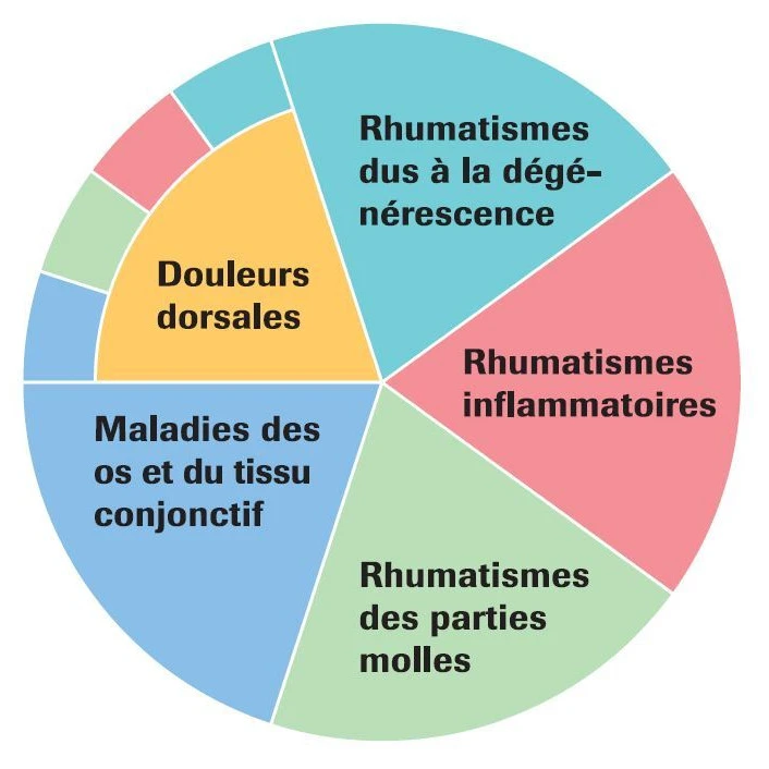 Les rhumatismes peuvent être classés en cinq formes différentes. Les rhumatismes peuvent être classés en cinq formes différentes.