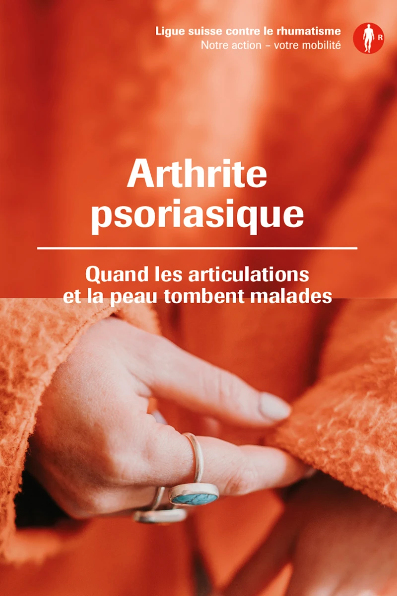 Nouvelle brochure sur l'arthrite psoriasique Nouvelle brochure sur l'arthrite psoriasique