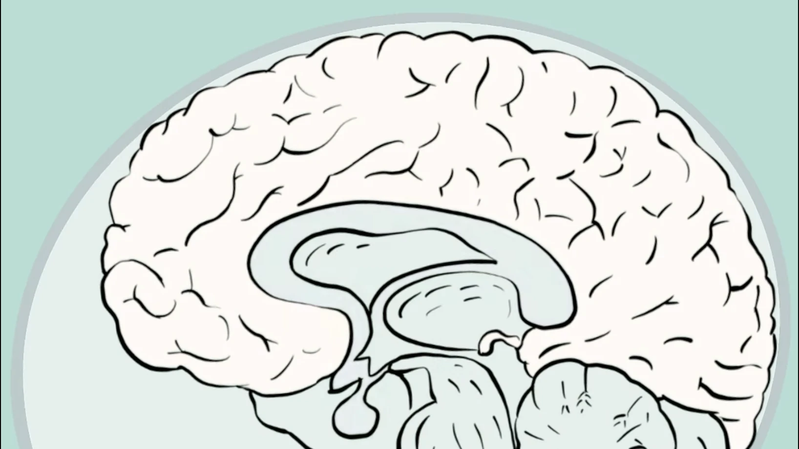 D'où viennent les douleurs ? Dessin du cerveau : d'où viennent les douleurs ?